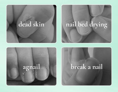 Nail Nourishment Cuticle Oil Pen Gel Suitable Hand/Feet Vitamin E Finger Nails Treatment Serum Nail Care