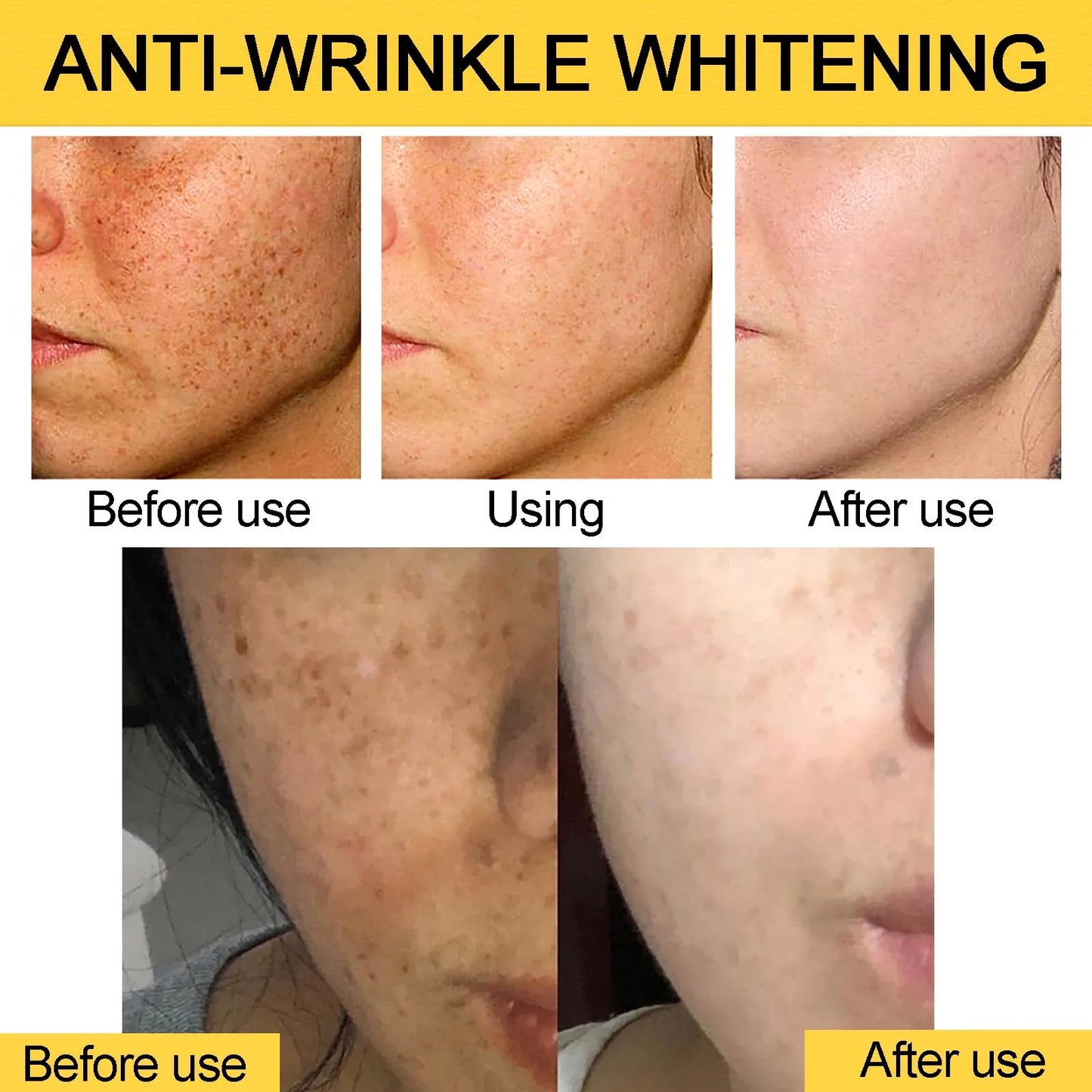 AILKE Carotene 3-In-1 Skin Care Set, Clean Skin With Niacinamide, Antioxidant, Improves Dull Skin For All Skin Types