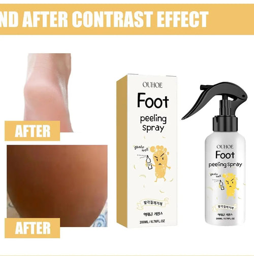 WhiteningFoot Exfoliating Spray Moisture Lock Callus Softener Anti Dry Crack Repair Odor Control Brightening Foot Care Liquid
