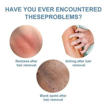 Hair removal spray powerful hair part healthy painless hair removal growth inhibitor male and female body care Korean products