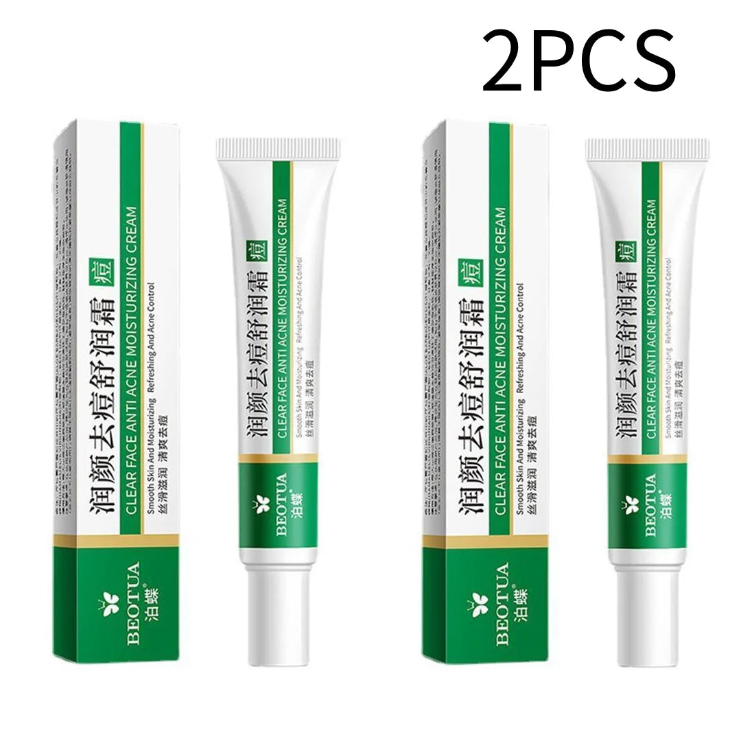 Acne-removing Moisturizing Cream Cleans Removes Acne  Moisturize Repair Acne Control Oil Control Cream Gentle Skin Care Cream