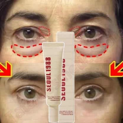 SEOUL 1988 Eye Cream Niacinamide 2% Retinal Acid Ginseng Serum Lighten Fine Lines Firming Pores Brightening Face Korean Skincare