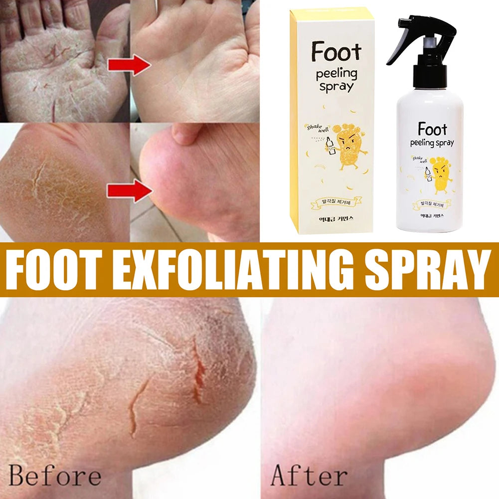 Foot Spray Exfoliate Nourish Moisturizing Skin Exfoliator File Feet Repair Dead Skin Rejuvenation For Foot Care For Women Men