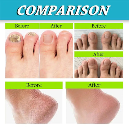 Anti-Sweat Spray Remove Bad Smell Foot Deodorant Spray Foot Artifact Footwear And Socks Foot Shoe Odor Deodorant Spray