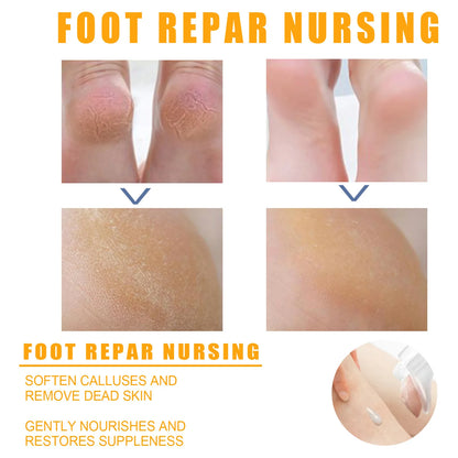 Herbal Anti Crack Foot Cream Spray Heel Cracking Repair Products Exfoliation Dead Skin Removal Softening Moisturize Smooth Care