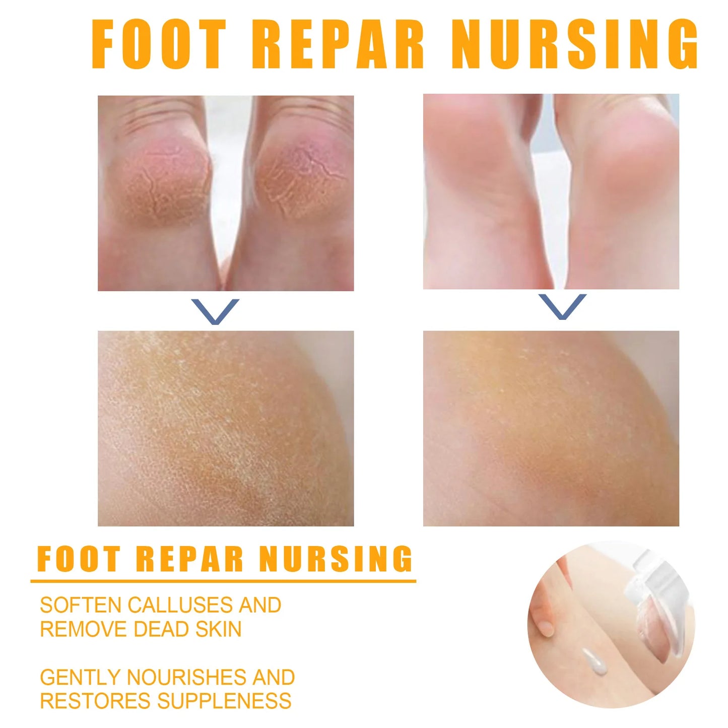 Herbal Anti Crack Foot Cream Spray Heel Cracking Repair Products Exfoliation Dead Skin Removal Softening Moisturize Smooth Care