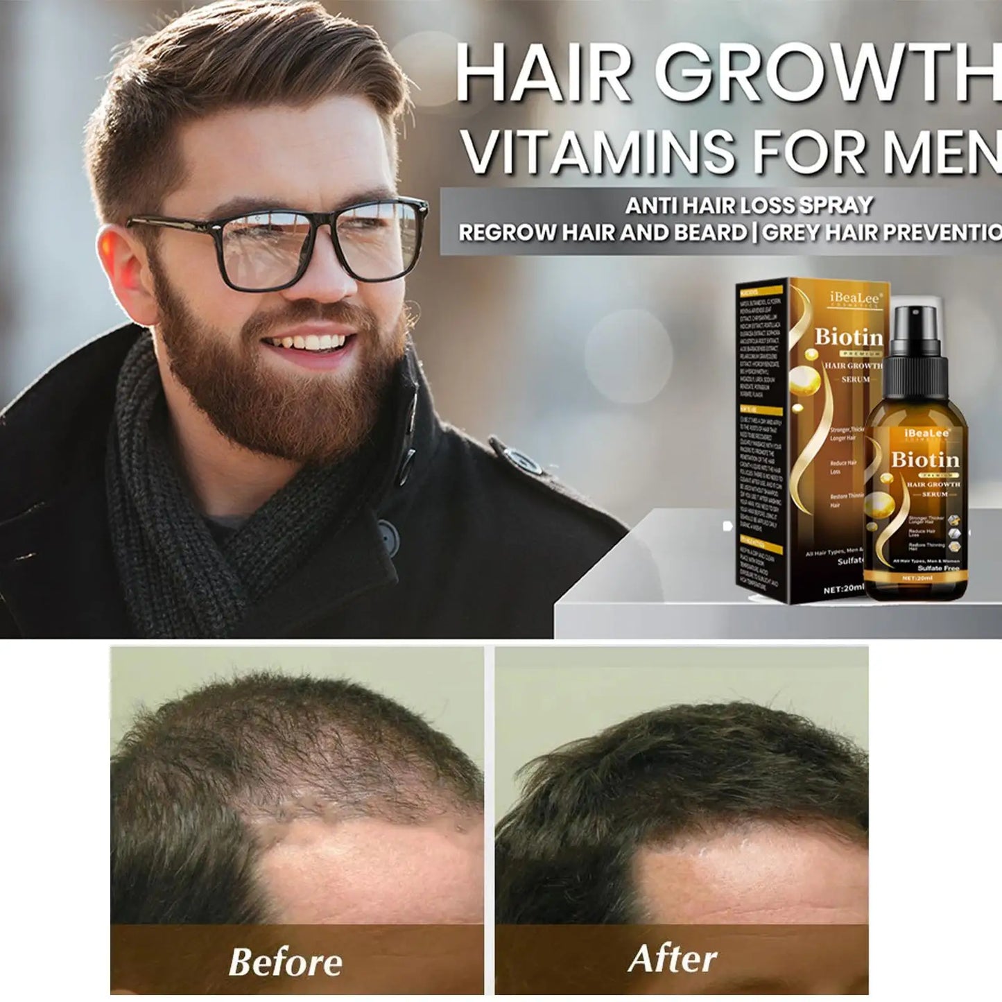 Scalp Repair Hair Thicken Conditioner Hair Thickening Care Products Beard Thickening Care Oil Serum Professional Hair Care