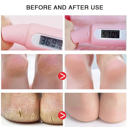 Herbal Anti Crack Foot Cream Spray Heel Cracking Repair Products Exfoliation Dead Skin Removal Softening Moisturize Smooth Care