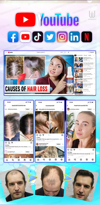 hair water spray, to meet the needs of most people