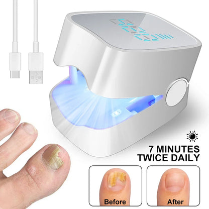 Nails Fungus Laser Treatment Device Rechargeable UV Lamp Fingernails Toenails Onychomycosis Therapy Sterilize Repair Care Tools
