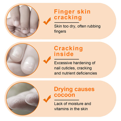 TWOING Vitamin E Nail Care Oils，Nail Cuticle Hydration & Nail Strengthening, Deeply Moisturizing for Healthier,Shinier,Nails 8ML