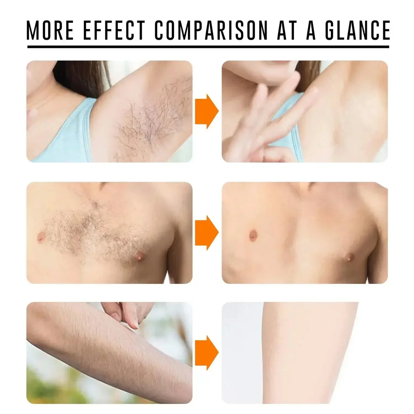 2 Minutes Fast Hair Removal Spray Painless Hair Growth Inhibitor Arm Armpit Leg Permanent Depilatory for Men Women Repair Care