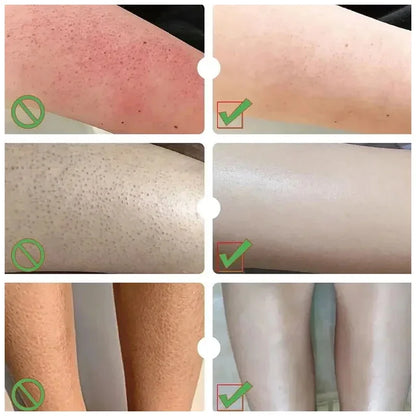 Herbal Anti Crack Foot Cream Peeling Spray Heel Cracking Repair Products Exfoliation Dead Skin Removal Softening Smooth Care