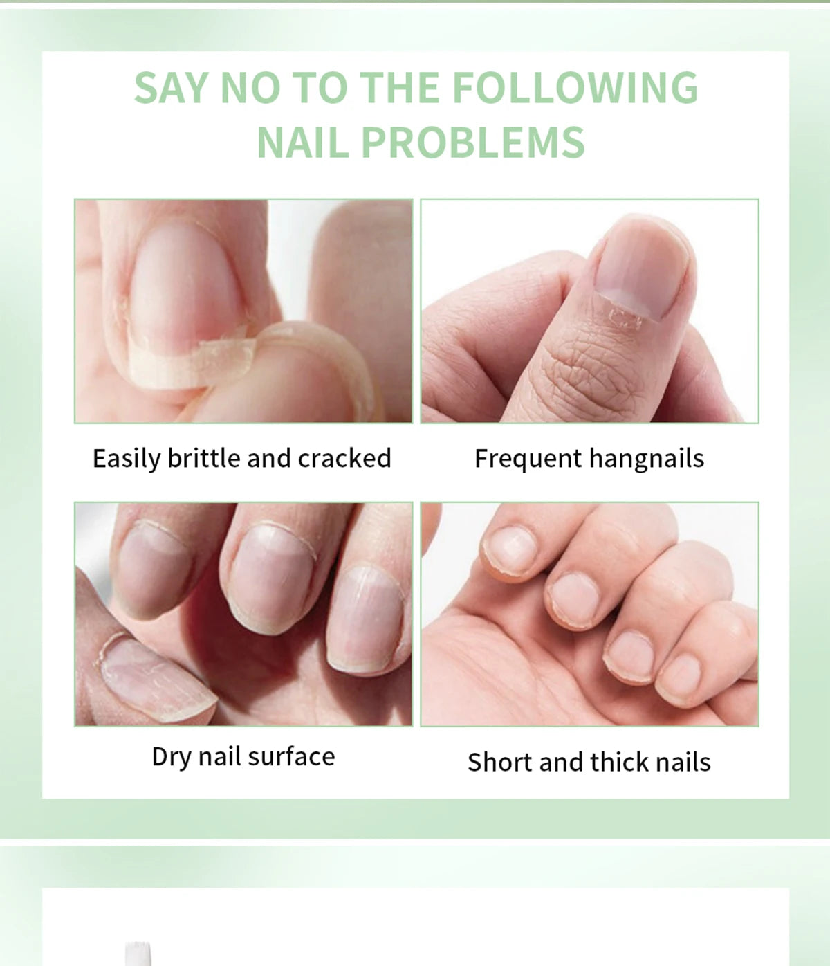 Nail Treat-Growth Oil Nail Nutrition Oil Pen Nail Treatment Cuticle Revitalizer Oil Prevent Nail Polish Agnail Nourish Skin