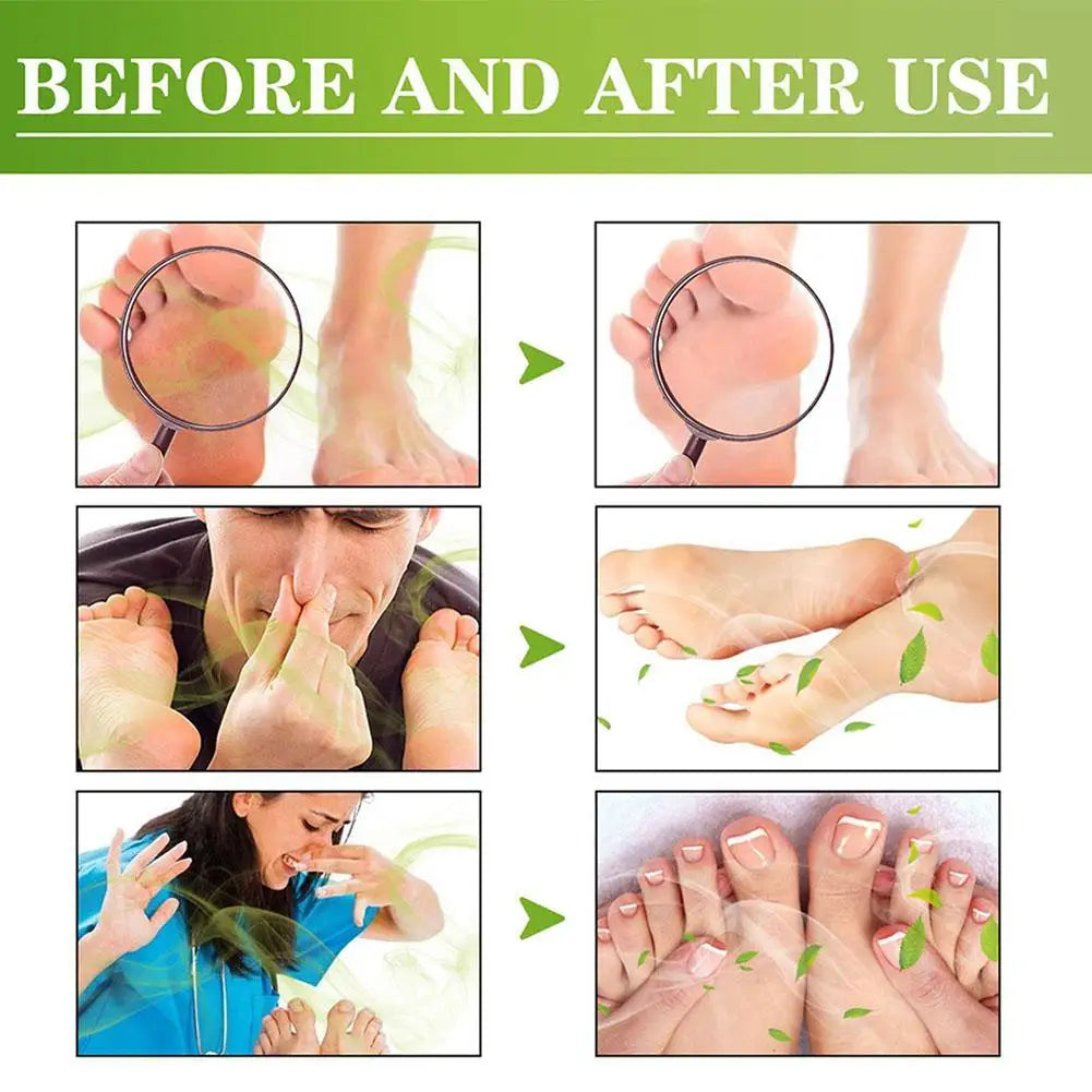 Fresh Foot Deodorant Spray Foot Spray Shoe Odor Remover For Sweaty Feet Natural Shoe Deodorizer And Foot Spray W5G1