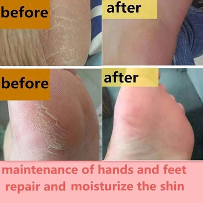 Herbal Anti Crack Foot Cream Peeling Spray Heel Cracking Repair Products Exfoliation Dead Skin Removal Softening Smooth Care