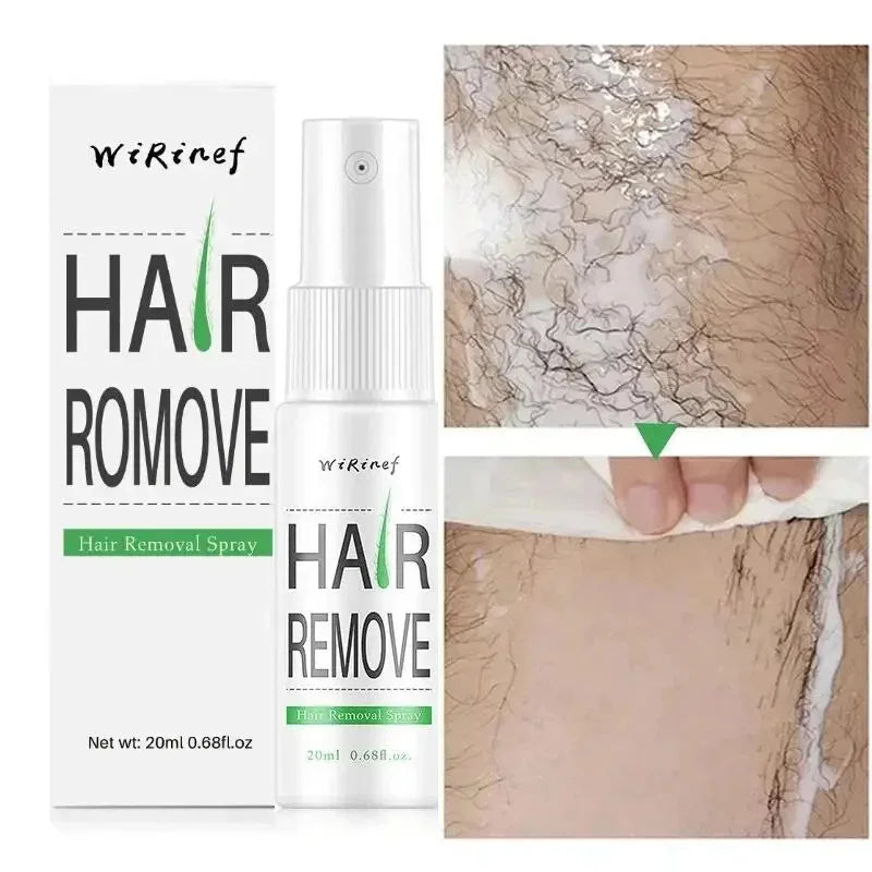 Fast Hair Removal Spray Painless Hair Growth Inhibitor Remove Armpit Leg Arm Permanent Depilatory for Men Women Repair Body Care