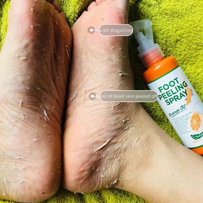 100ML Foot Peeling Spray Elbow Exfoliating Essence Pedicure Cosmetics