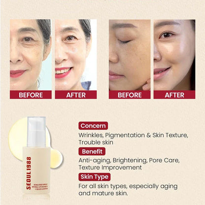 SEOUL 1988 Eye Cream Niacinamide 2% Retinal Acid Ginseng Serum Lighten Fine Lines Firming Pores Brightening Face Korean Skincare