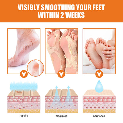 100ml Foot Peeling Spray Orange Essential Oil Exfoliating Nourish Peel Feet Calluses Dead Skin Remover Pedicure Foot Care Tool