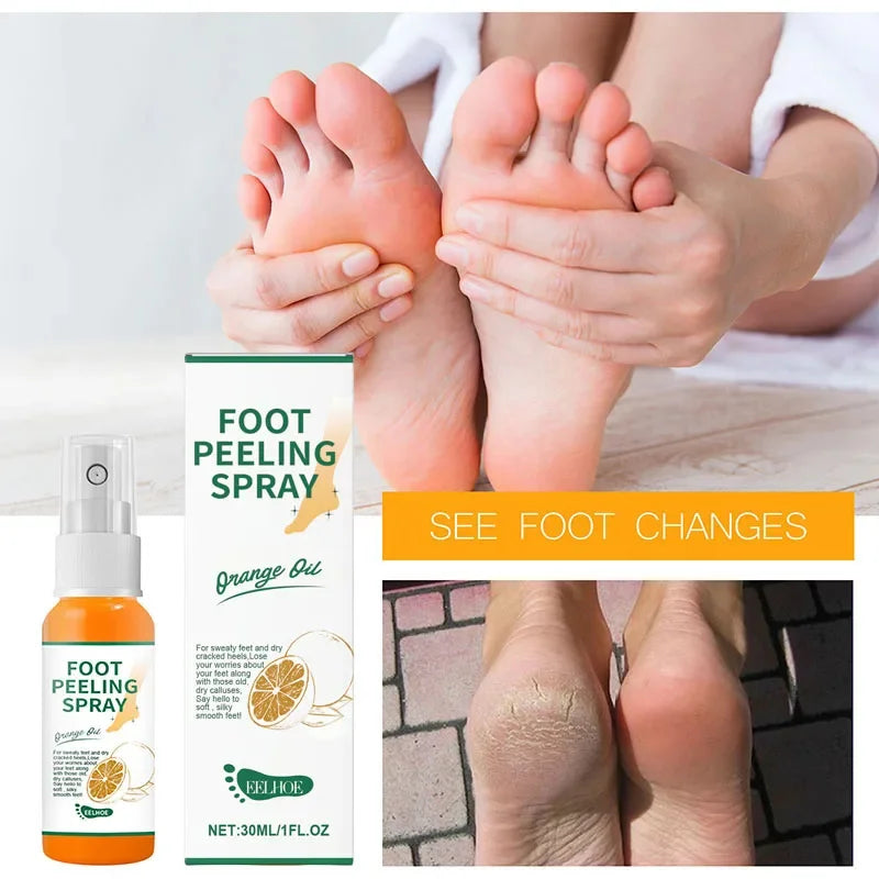 Herbal Anti Crack Foot Cream Peeling Spray Heel Cracking Repair Products Exfoliation Dead Skin Removal Softening Smooth Care