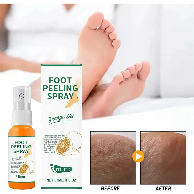 Herbal Anti Crack Foot Cream Peeling Spray Heel Cracking Repair Products Exfoliation Dead Skin Removal Softening Smooth Care