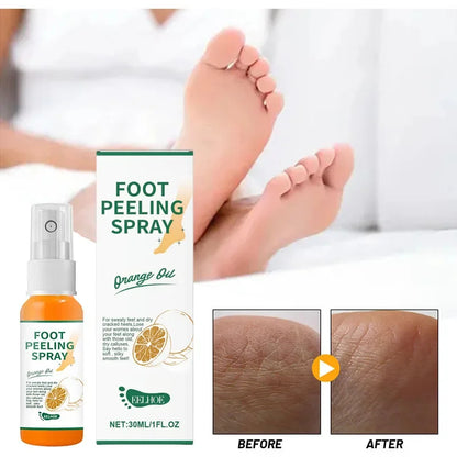 Herbal Anti Crack Foot Cream Peeling Spray Heel Cracking Repair Products Exfoliation Dead Skin Removal Softening Smooth Care