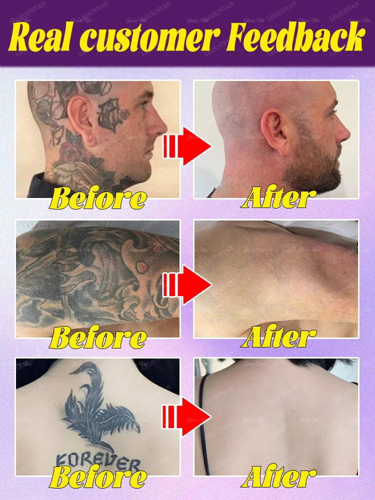 Tattoo dissolving spray, plant extracts, fast and effective deep cleaning, no laser required