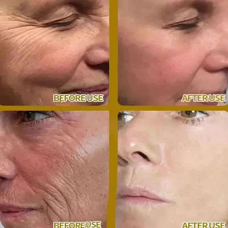 SEOUL 1988 Eye Cream Niacinamide 2% Retinal Acid Ginseng Serum Lighten Fine Lines Firming Pores Brightening Face Korean Skincare