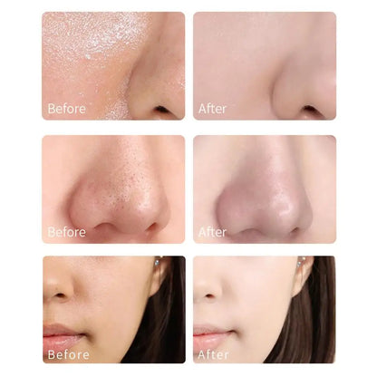 Bubble Skin Care And Cleaning Cream Moisturizer Detoxifying Clay Mask Exfoliating water oil balance shrink pores