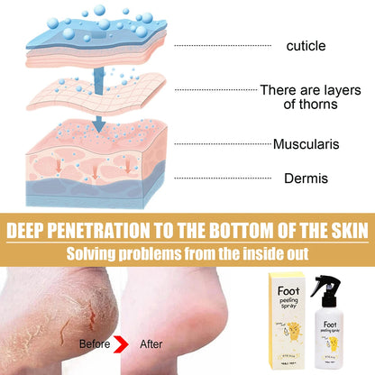 Foot Spray Exfoliate Nourish Moisturizing Skin Exfoliator File Feet Repair Dead Skin Rejuvenation For Foot Care For Women Men