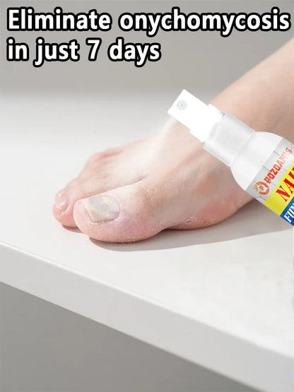 2025 Toenail Fungus Spray Nail Repair Spray Discoloration Damaged Nails Foot Care Tool
