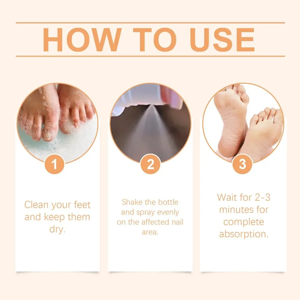 Bee Venom Nail Soothing Spray Nail Growth Spray Bee Venom Nail Treatment Cleaning Spray for Hand Foot Nails Hongos Uñas Pies