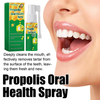 20ml Propolis Oral Spray Oral Treatment Effectively Clean Breath Keeps Oral Mouth Bad Care Refresh