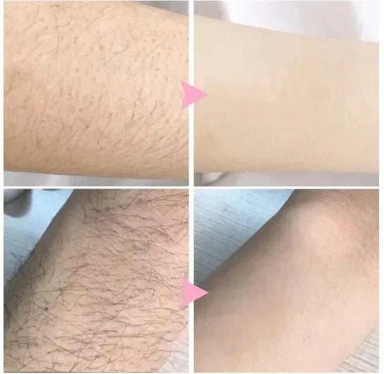 Hair removal spray powerful hair part healthy painless hair removal growth inhibitor male and female body care Korean products