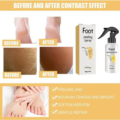 Foot Exfoliating Spray Repair Brightening Anti-Drying Crack Peeling Dead Skin Calluses Odor Removal Whitening Feet Care Liquid
