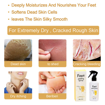 Foot Spray Exfoliate Nourish Moisturizing Skin Exfoliator File Feet Repair Dead Skin Rejuvenation For Foot Care For Women Men