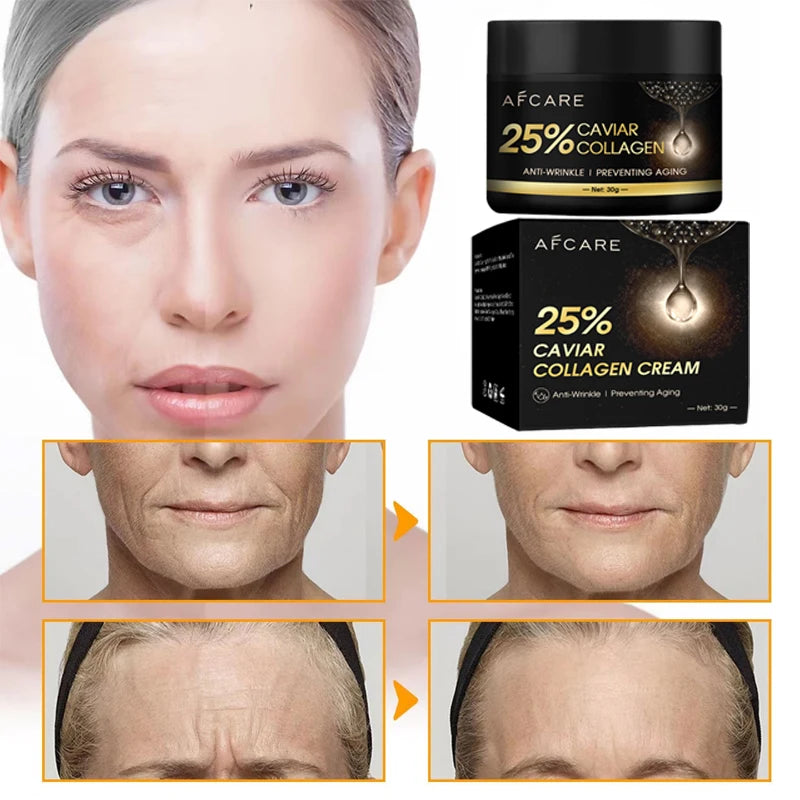 Caviar Collagen Cream Moisturizer Anti Wrinkle Lifting Firming Face Wrinkle Cream Brighten Korean Skin Care Product