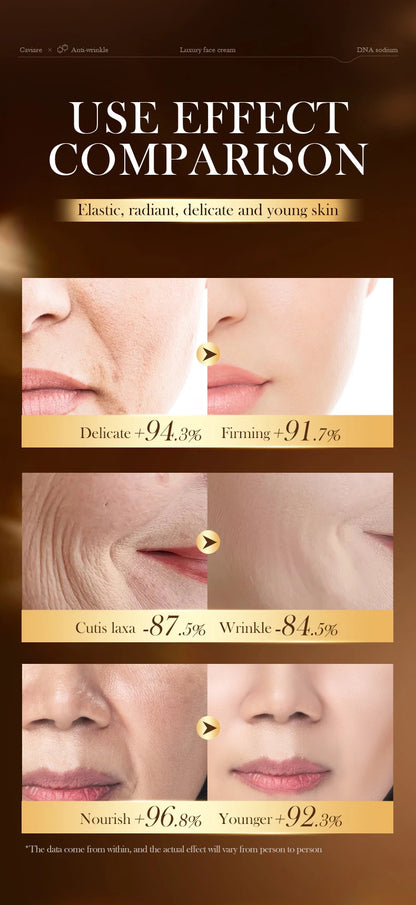 Caviar Anti-Wrinkle Face Cream Collagen Anti-Aging Firming Lift Fade Fine Lines Moisturizing Smooth Brighten Skin Care Products