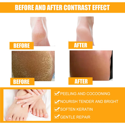 Herbal Anti Crack Foot Cream Spray Heel Cracking Repair Products Exfoliation Dead Skin Removal Softening Moisturize Smooth Care