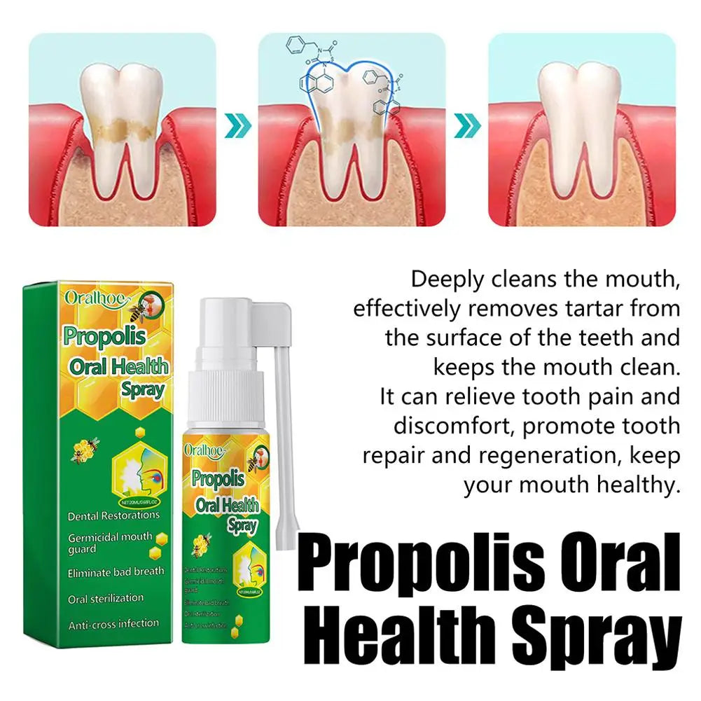 20ml Propolis Oral Spray Oral Treatment Effectively Clean Breath Keeps Oral Mouth Bad Care Refresh