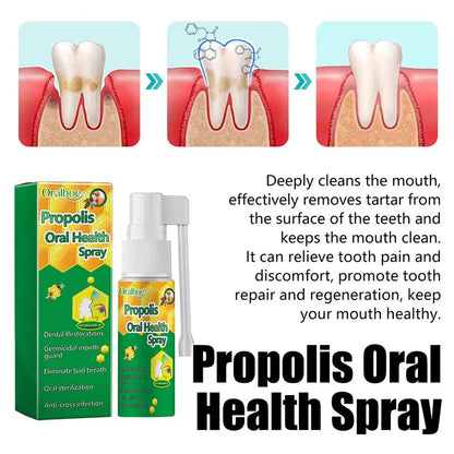 20ml Propolis Oral Spray Oral Treatment Effectively Clean Breath Keeps Oral Mouth Bad Care Refresh