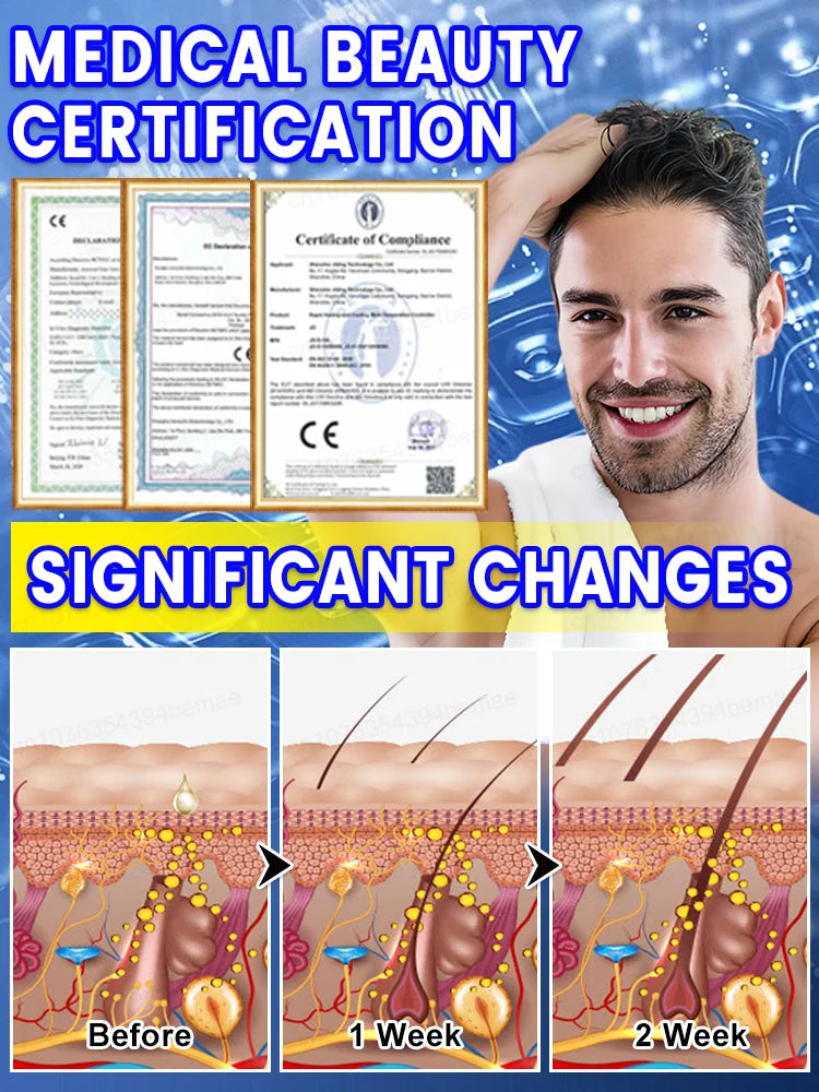 VideoHair-Spray de croissance des cheveux pour hommes et femmes, traitement anti-chute de cheveux, huile d'essence