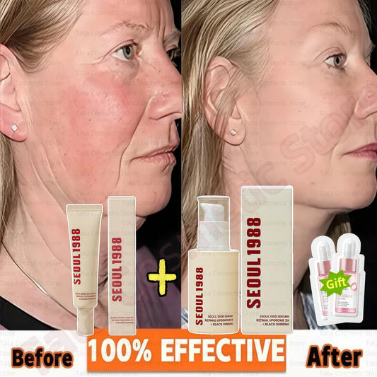 SEOUL 1988 Eye Cream Niacinamide 2% Retinal Acid Ginseng Serum Lighten Fine Lines Firming Pores Brightening Face Korean Skincare