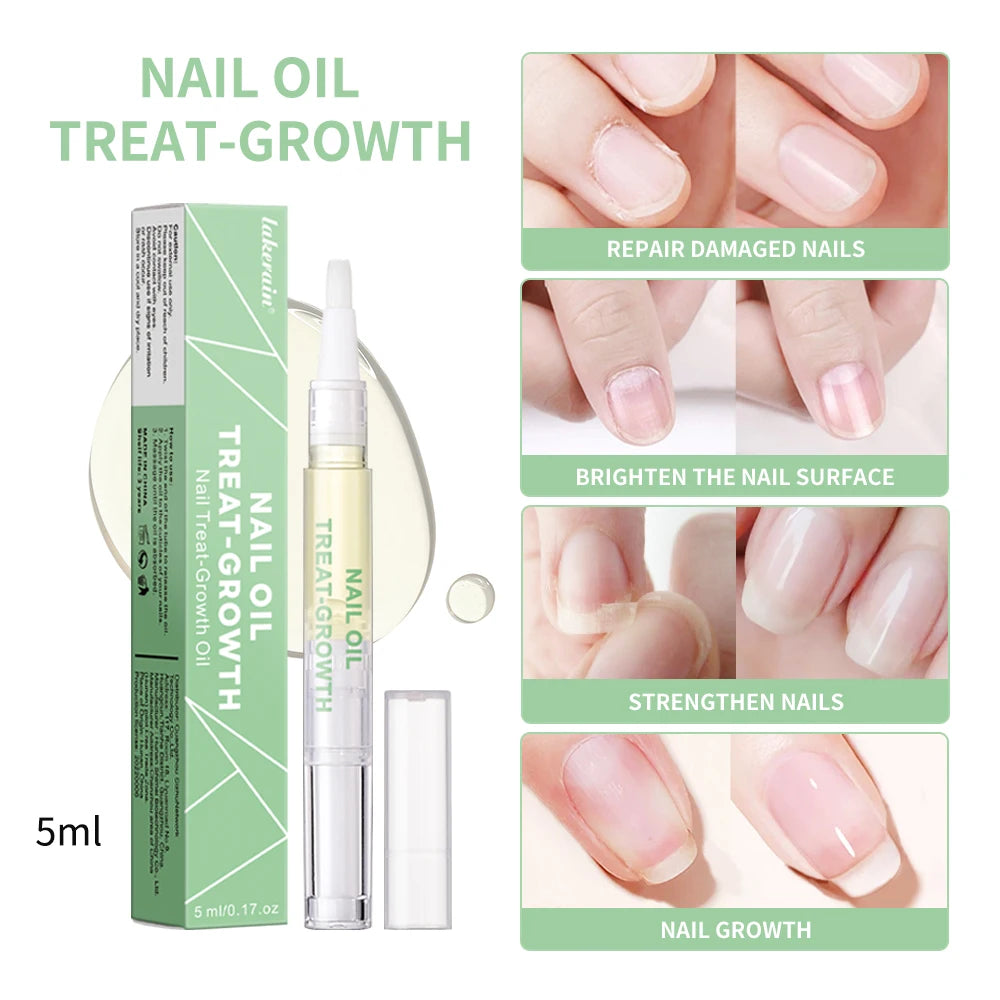 Nail Treat-Growth Oil Nail Nutrition Oil Pen Nail Treatment Cuticle Revitalizer Oil Prevent Nail Polish Agnail Nourish Skin