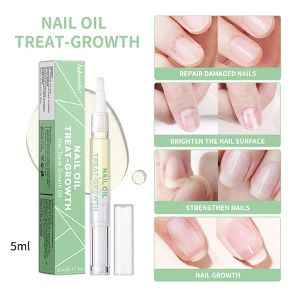 Nail Treat-Growth Oil Nail Nutrition Oil Pen Nail Treatment Cuticle Revitalizer Oil Prevent Nail Polish Agnail Nourish Skin