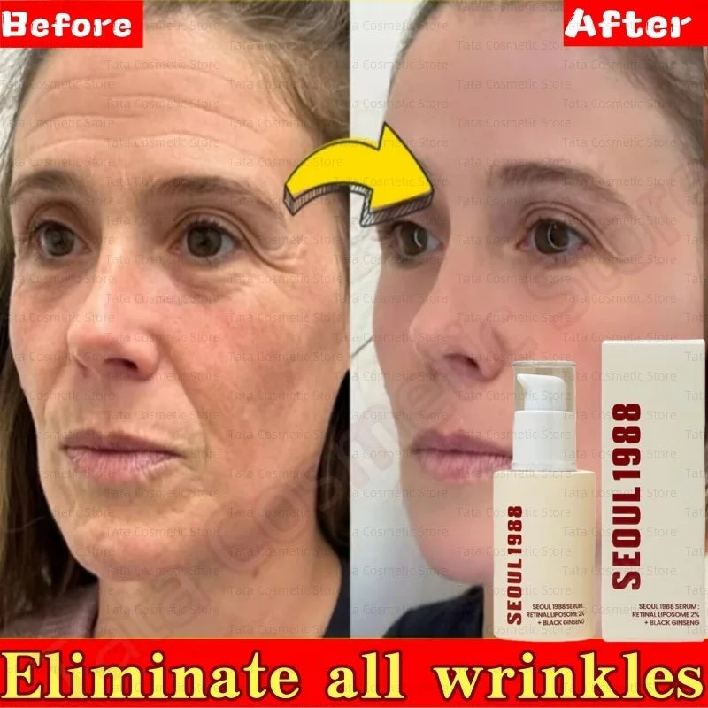 SEOUL 1988 Eye Cream Niacinamide 2% Retinal Acid Ginseng Serum Lighten Fine Lines Firming Pores Brightening Face Korean Skincare