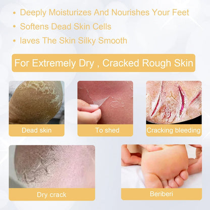 WhiteningFoot Exfoliating Spray Moisture Lock Callus Softener Anti Dry Crack Repair Odor Control Brightening Foot Care Liquid